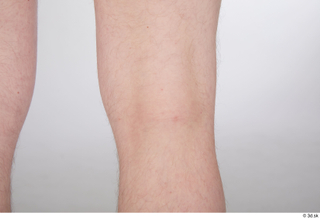 Sigvid knee nude 0005.jpg